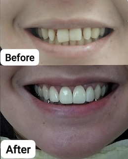 Advanced Treatment Room - San Rafael Dental Mandaluyong