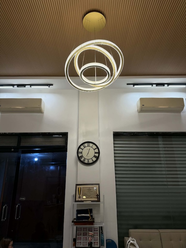 Teeth Whitening Before & After - Mandaluyong